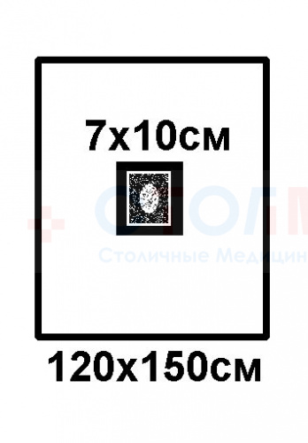 Простыня хирургическая с отверстием адгезивная 150x120cм (вырез 7х10см) стерильная фото 2 Простыня хирургическая с отверстием адгезивная 150x120cм (вырез 7х10см) стерильная фото 2
